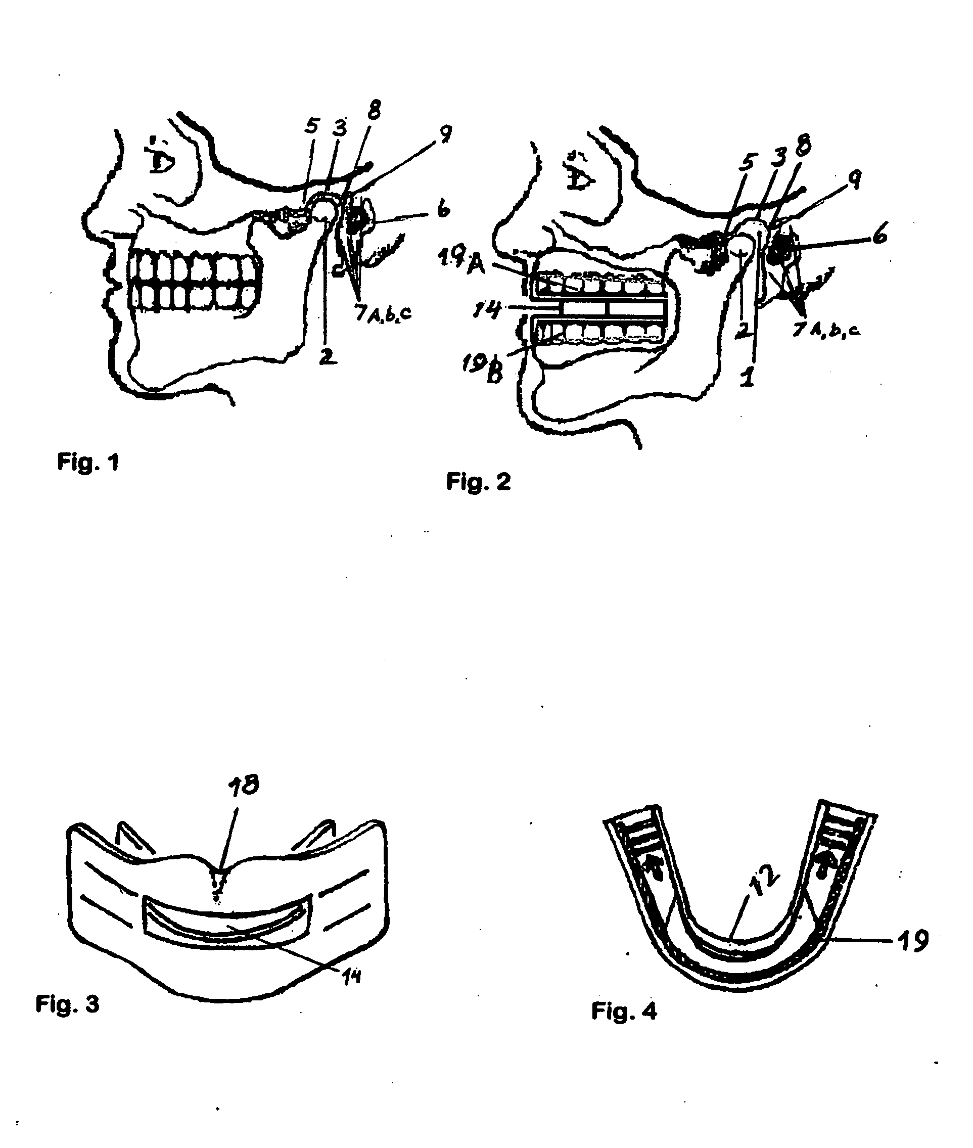 Dual use exercise whitener appliance