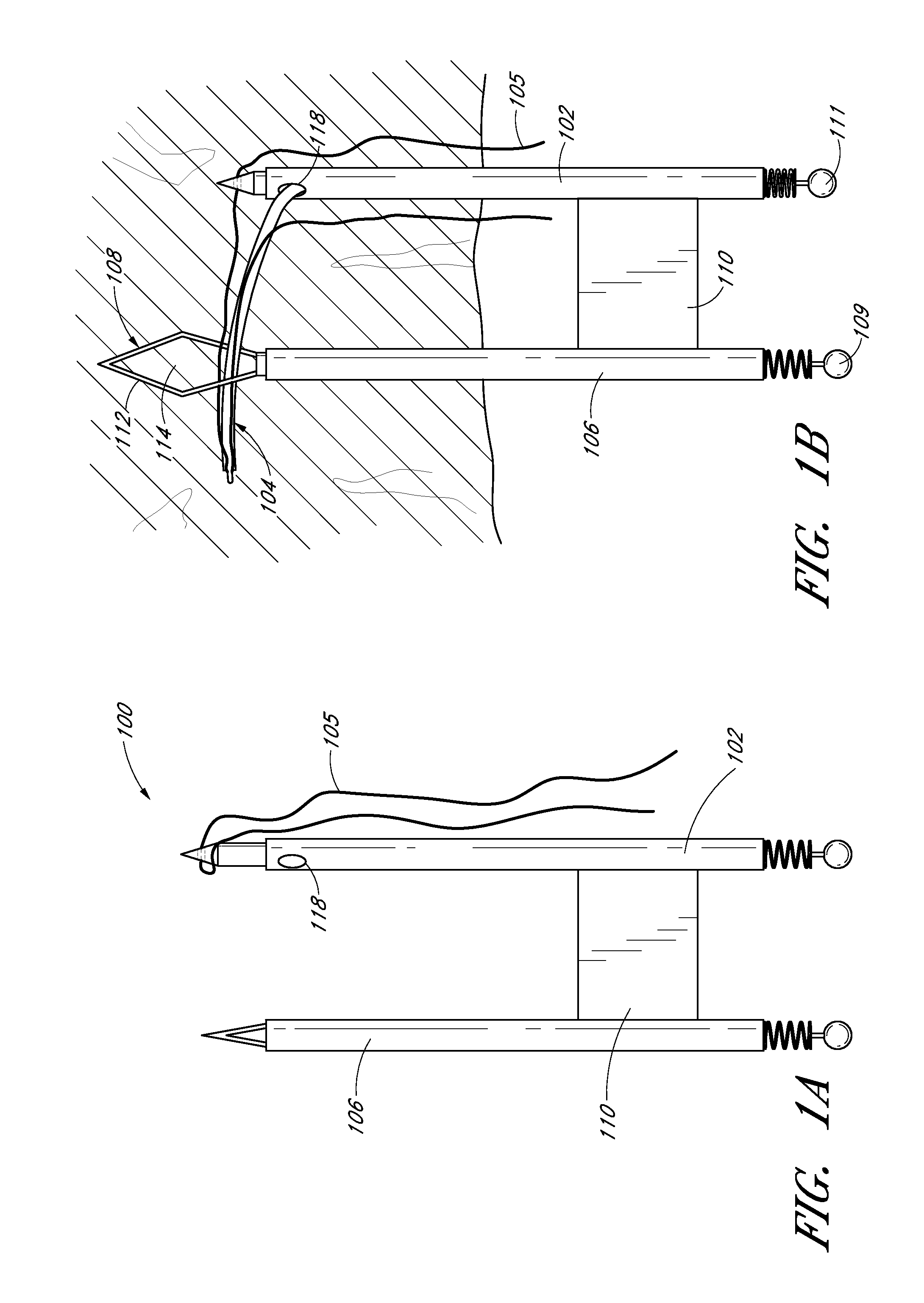 Suture passer systems and methods for tongue or other tissue suspension and compression