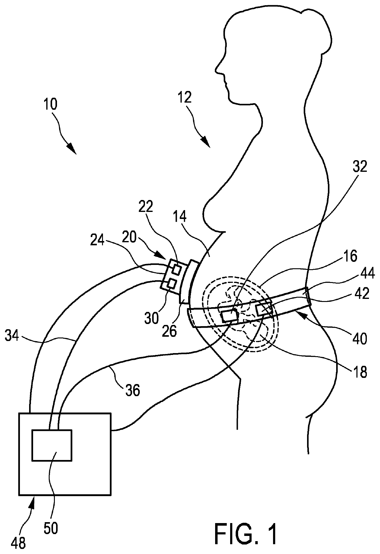 Pregnancy monitoring system and method