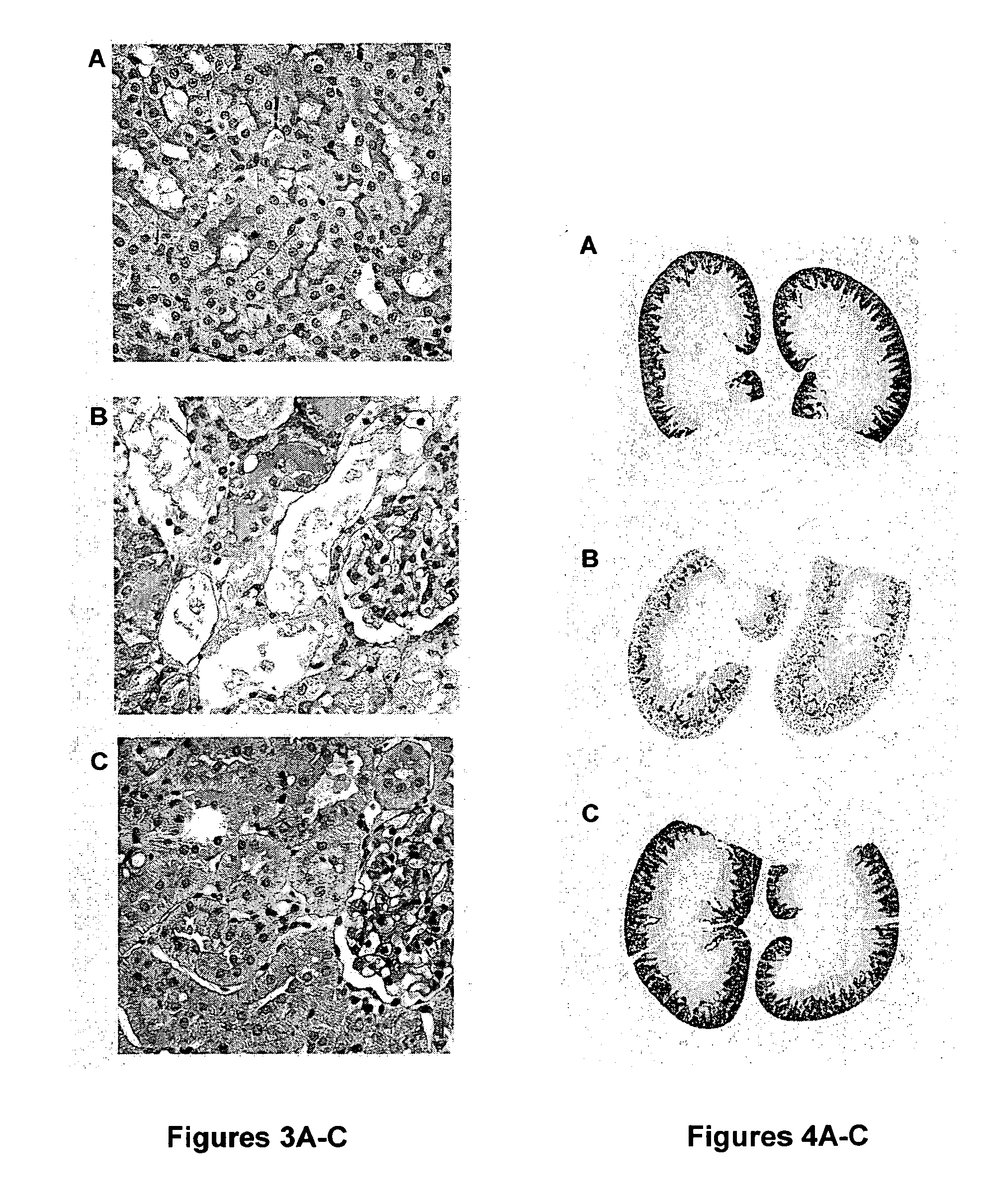 Attenuation of disorders by aminoglycosides