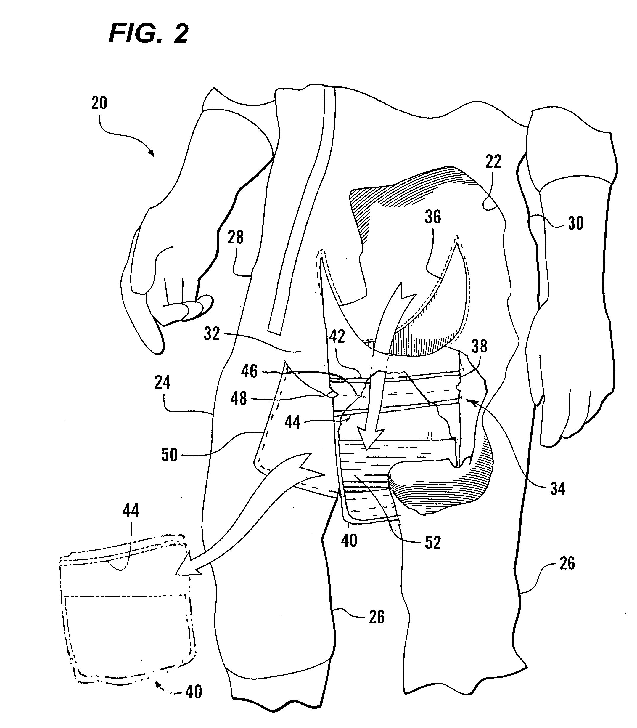 Human waste management suit