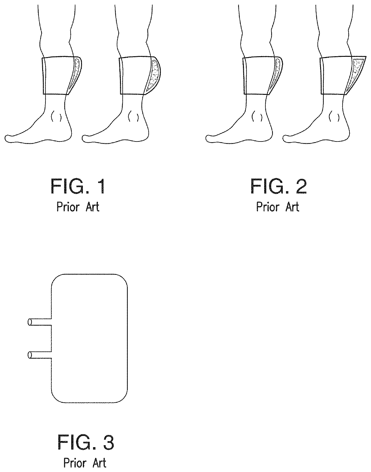 Intermittent Pneumatic Compression System