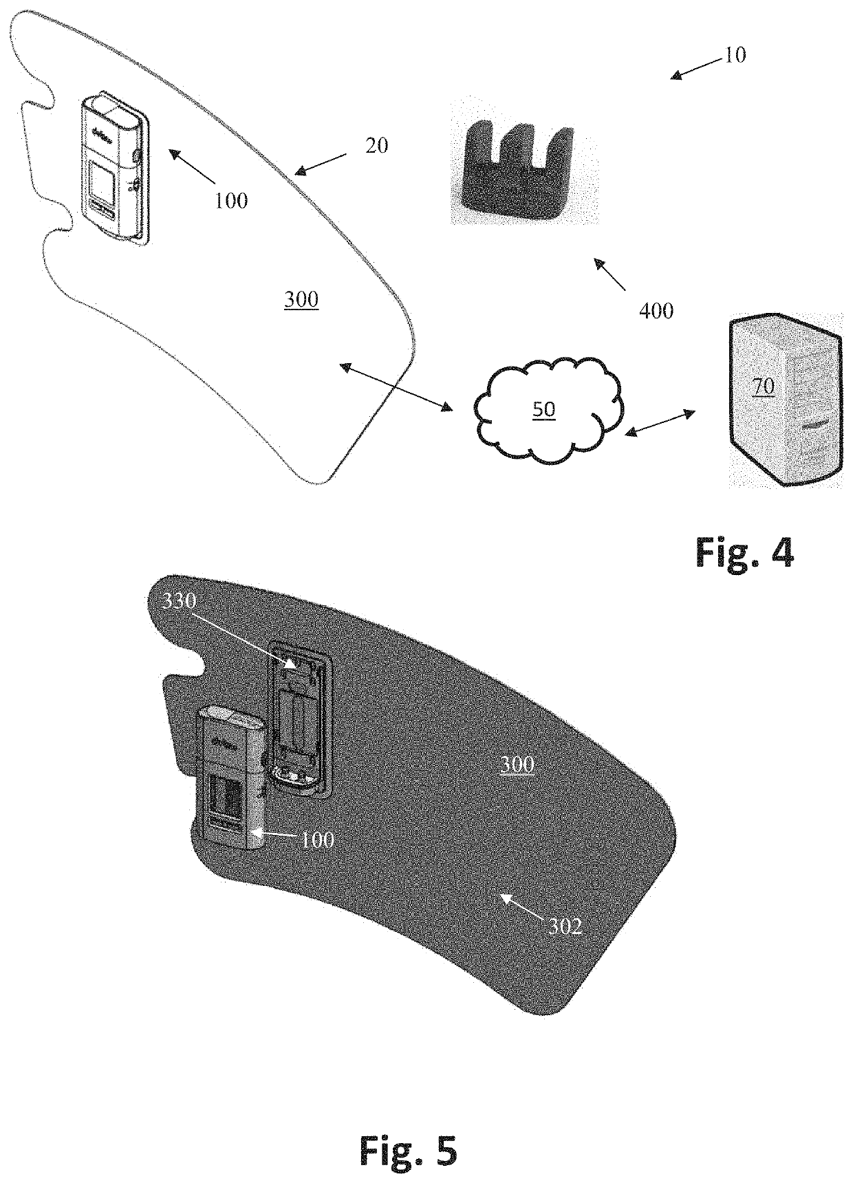 Intermittent Pneumatic Compression System