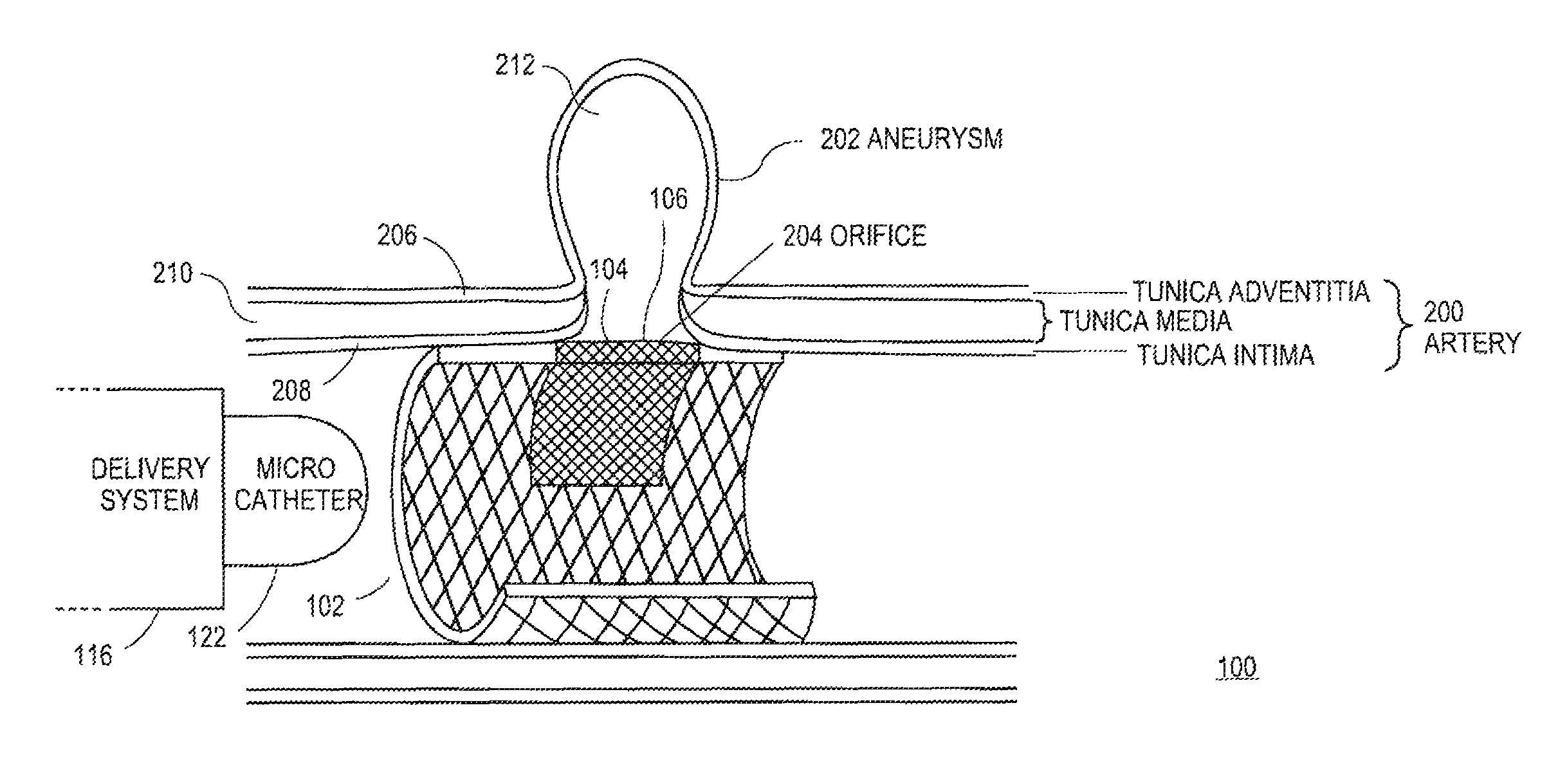 Systems and methods for magnetized stent having growth-promoting properties