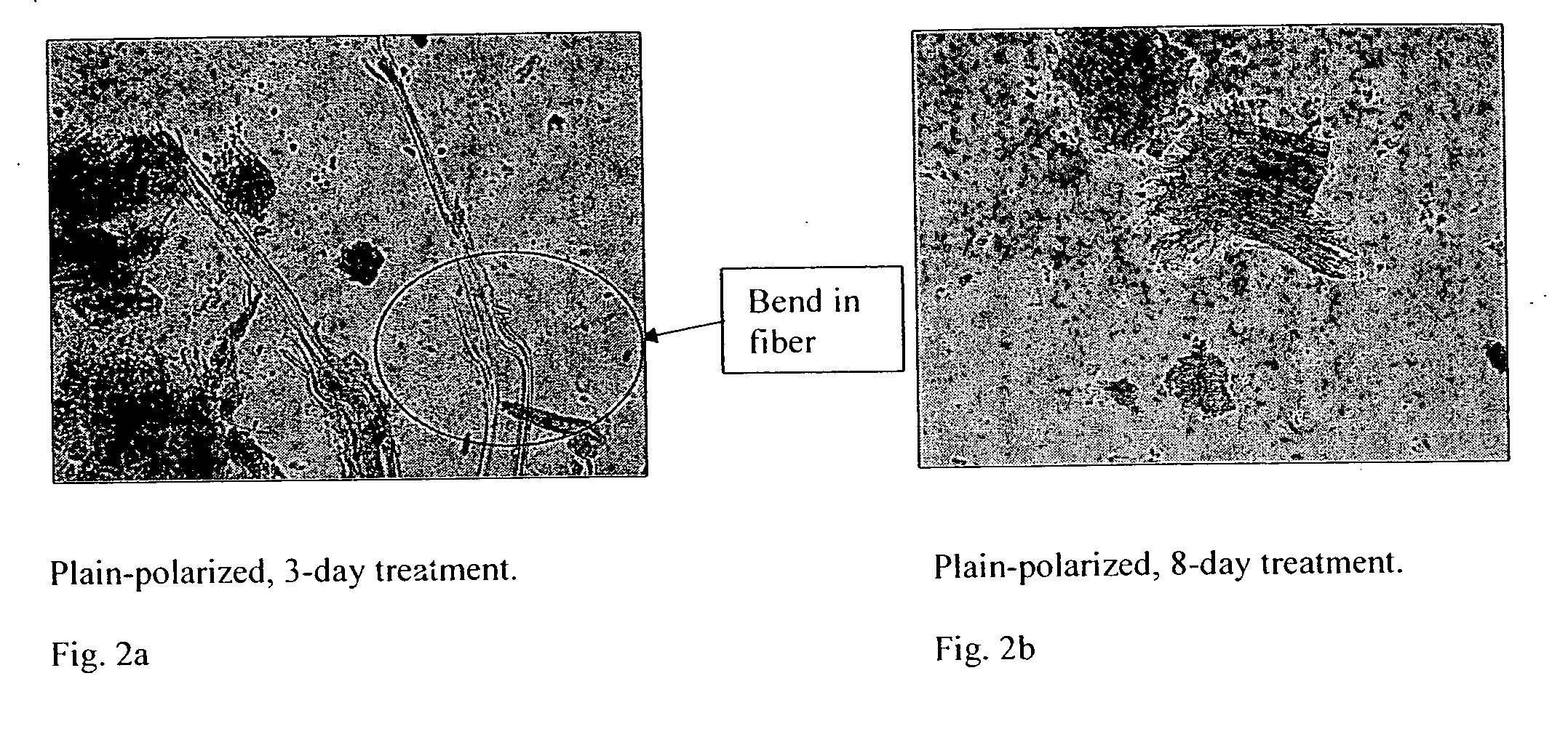 In-situ treatment of asbestos-containing material