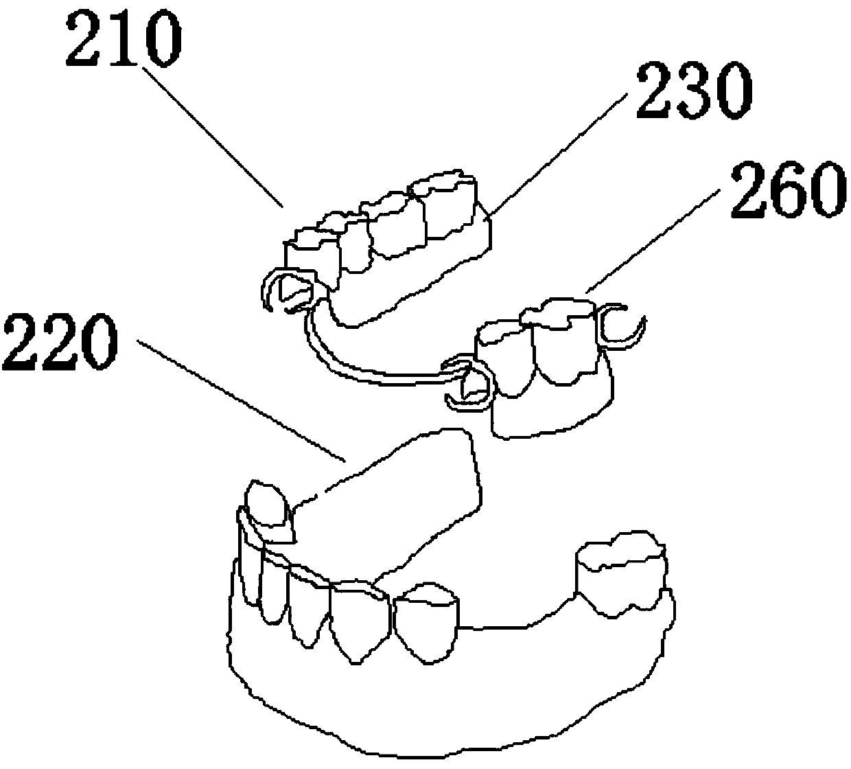 Secondary fine restoration method for denture and preparation of restoration material