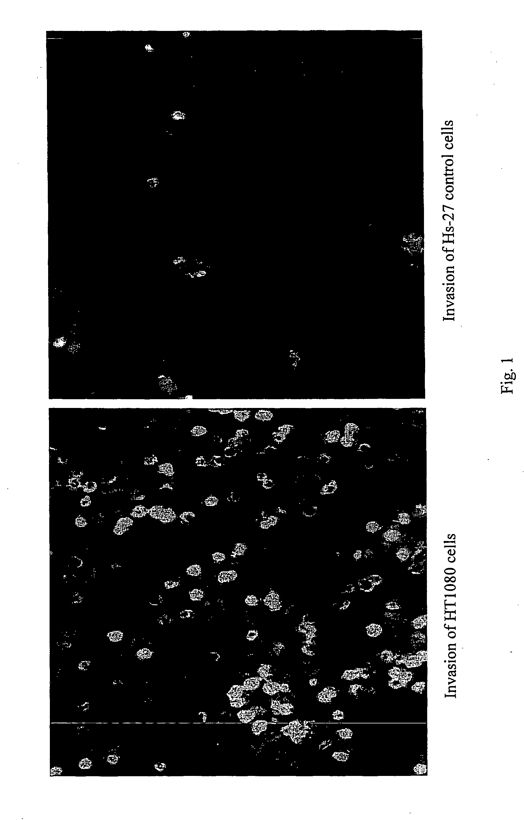 Neuropilin-1 inhibitors