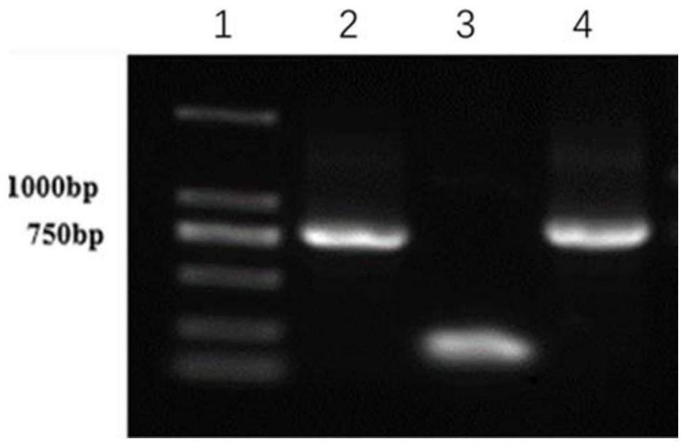 Fusion protein, vaccine containing fusion protein and application of fusion protein