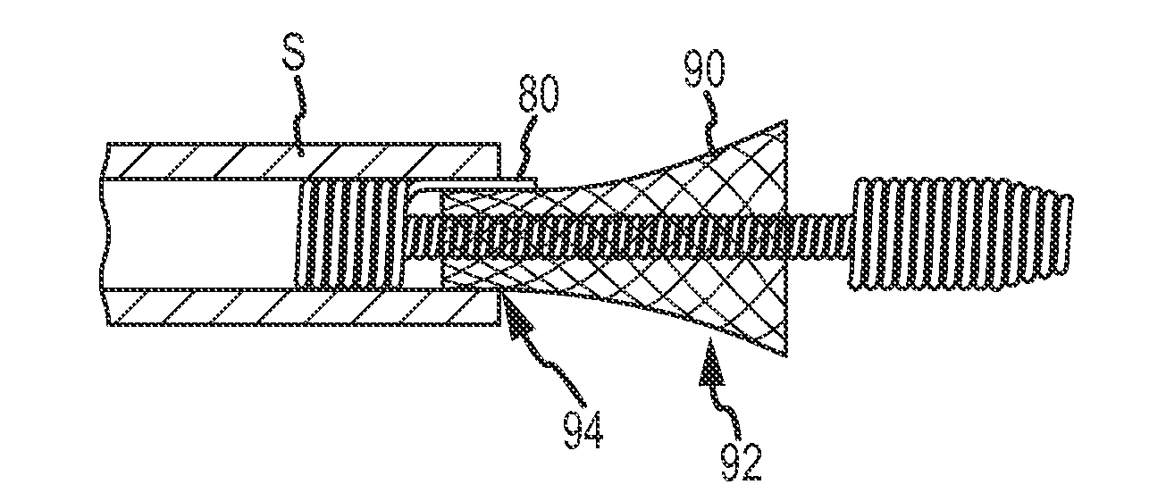 System for delivering a stent