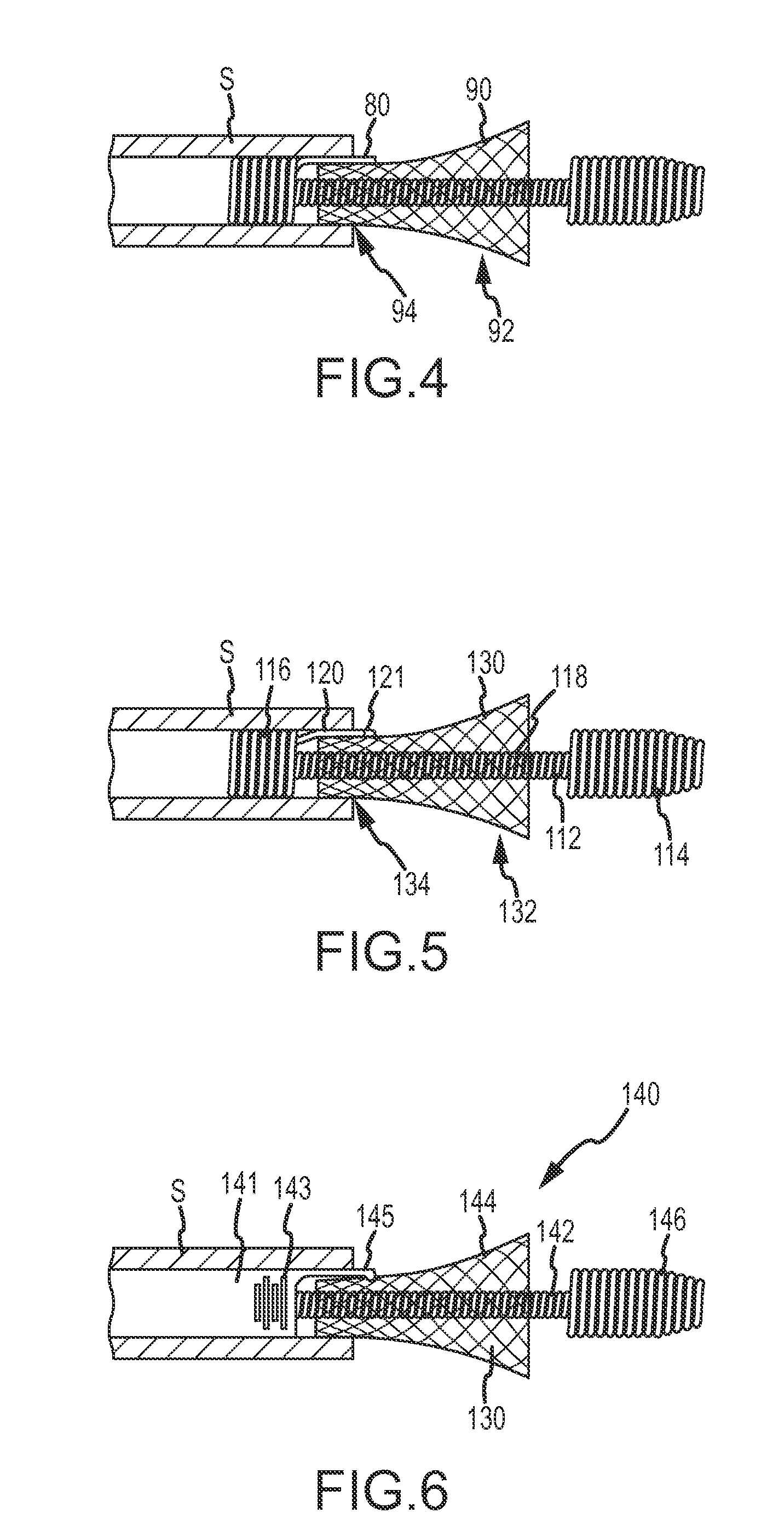 System for delivering a stent