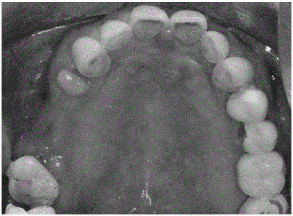 Automatic CAD/CAM/3D processing method of dental prostheses