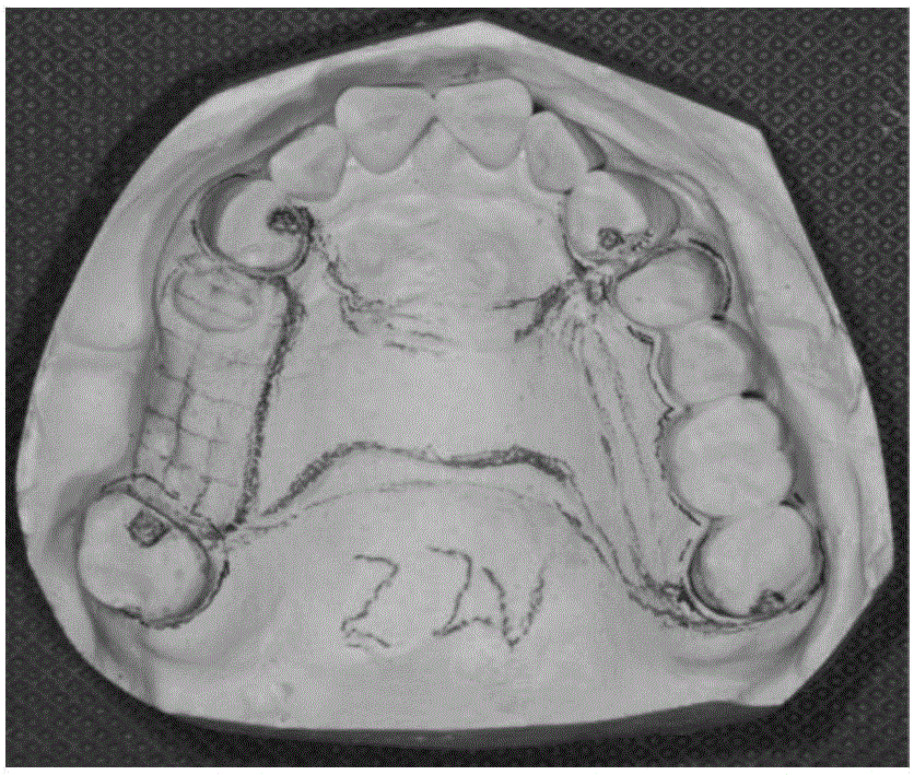 Automatic CAD/CAM/3D processing method of dental prostheses