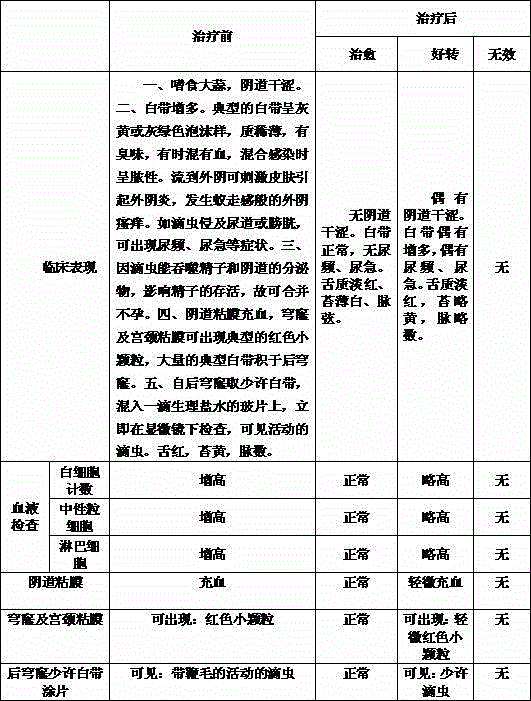 Preparation method of Chinese medicine irrigation solution for treating garlic addiction type trichomonas vaginitis