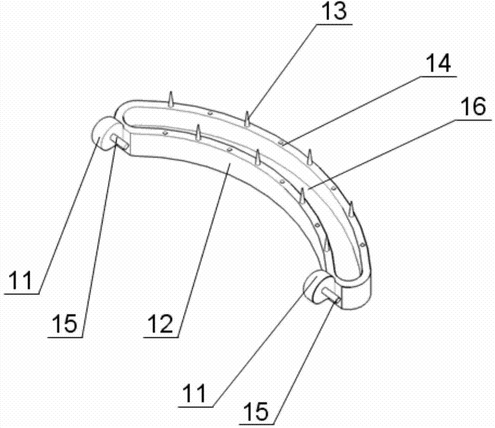 A closed repair device for rectovaginal fistula