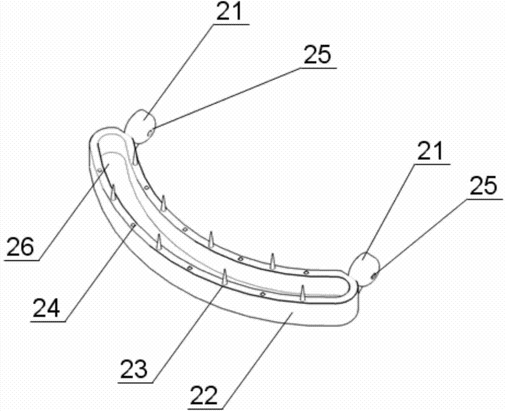 A closed repair device for rectovaginal fistula