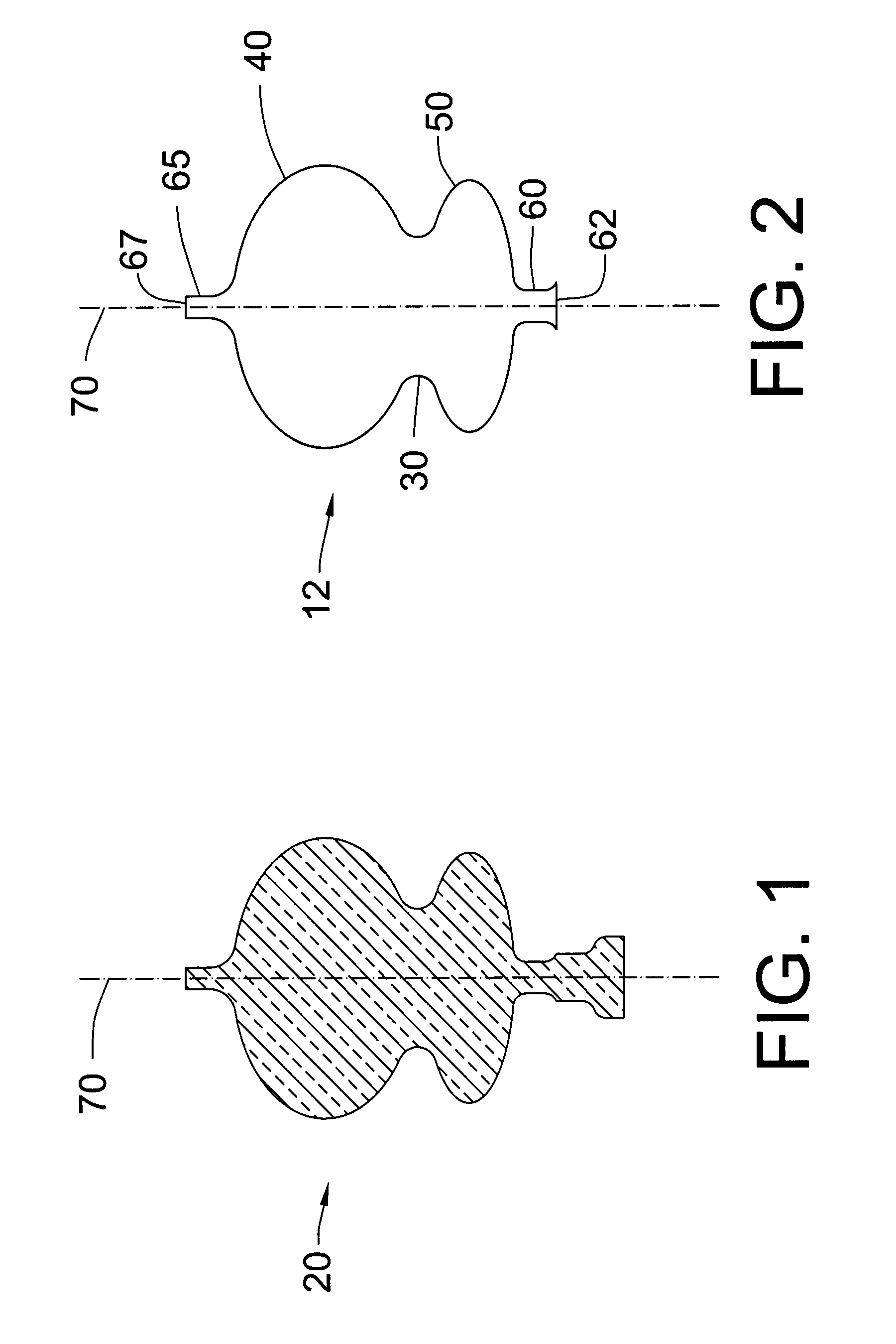 Over-the-wire exclusion device and system for delivery