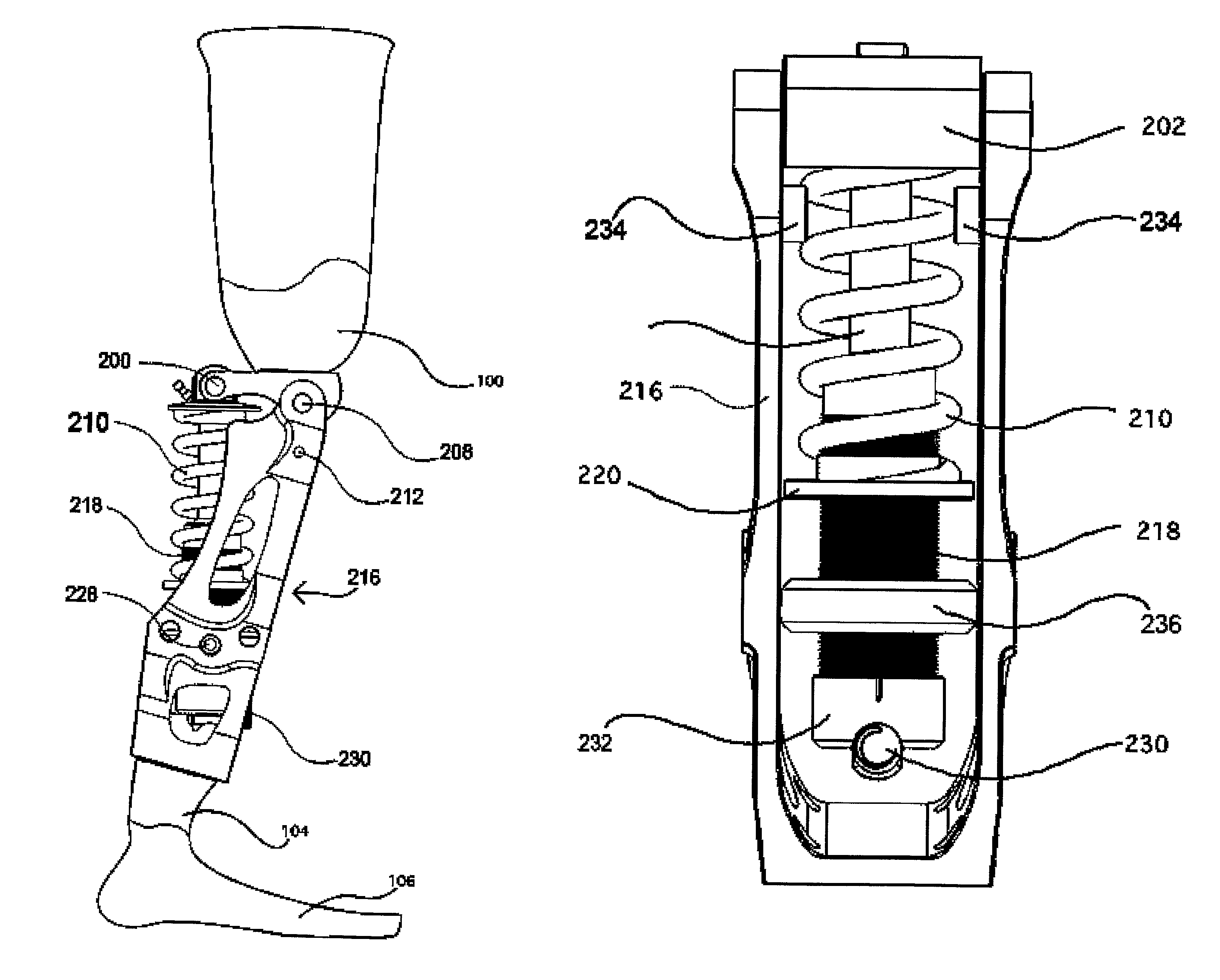 Prosthetic knee and leg assembly for use in athletic activities in which the quadriceps are normally used for support and dynamic function