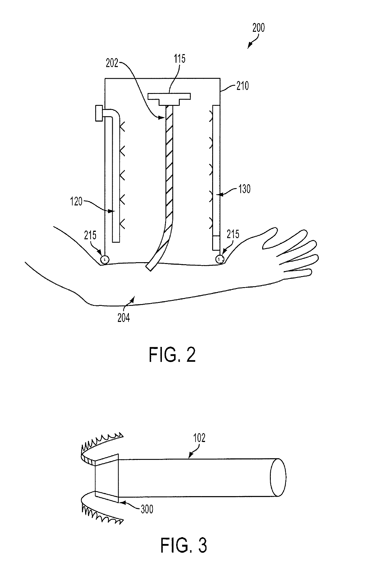 Vessel treatment systems, methods, and kits