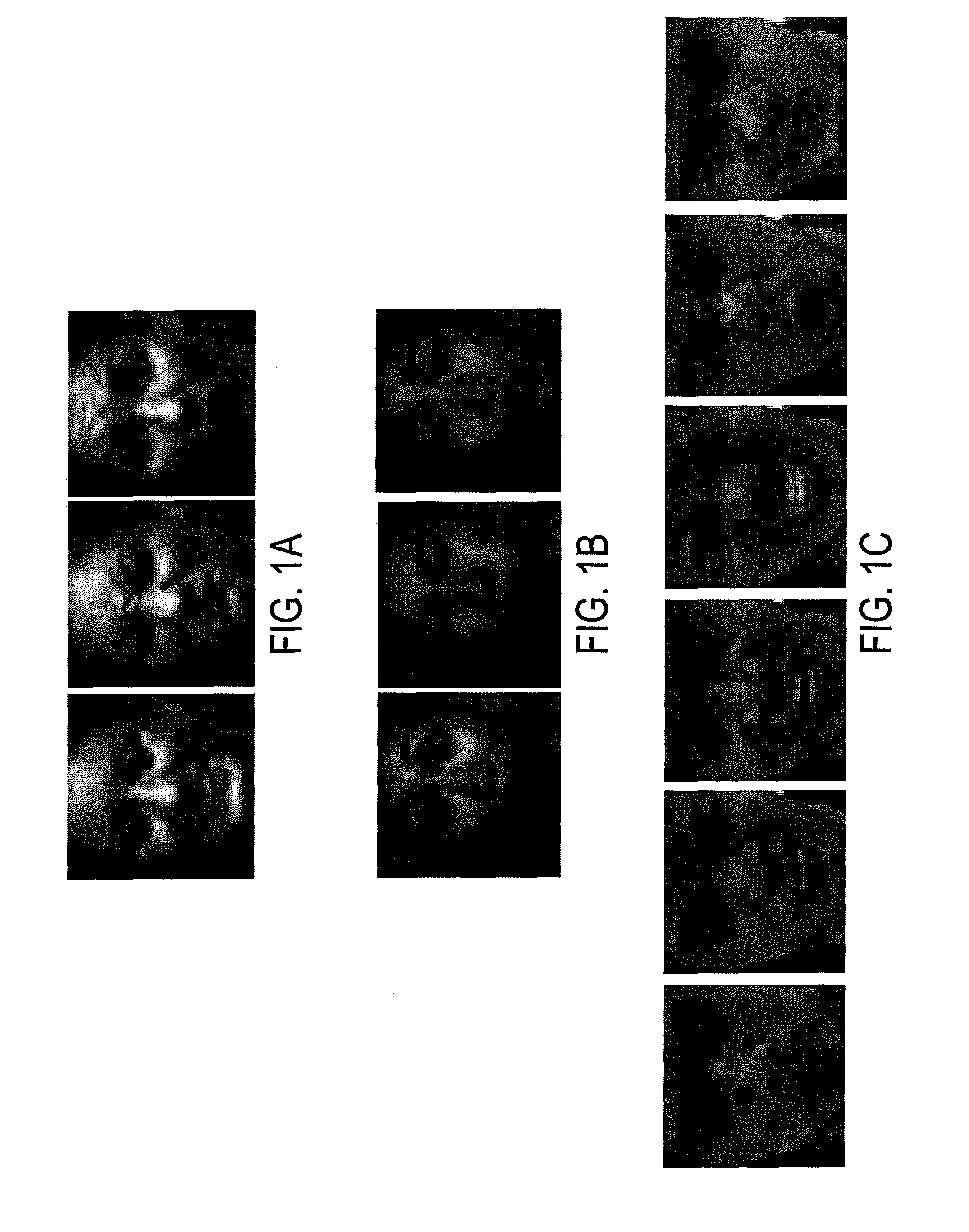 Ultra-low dimensional representation for face recognition under varying expressions