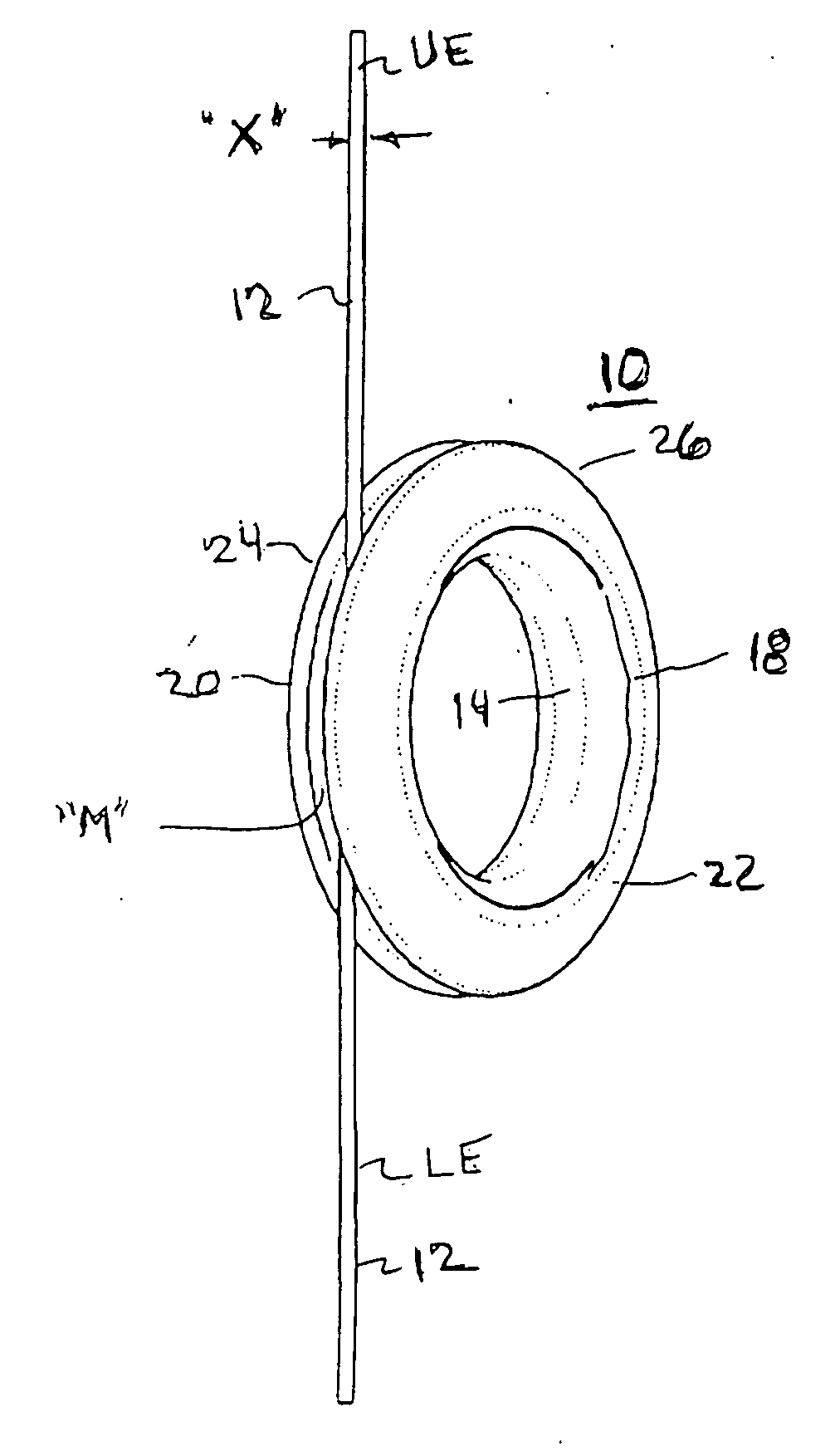 Hanging cable shortener arrangement