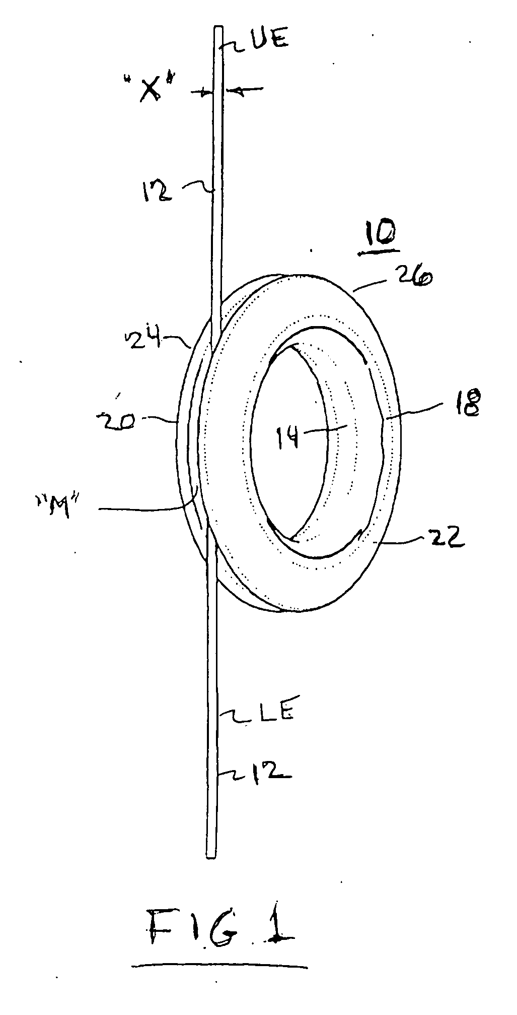 Hanging cable shortener arrangement