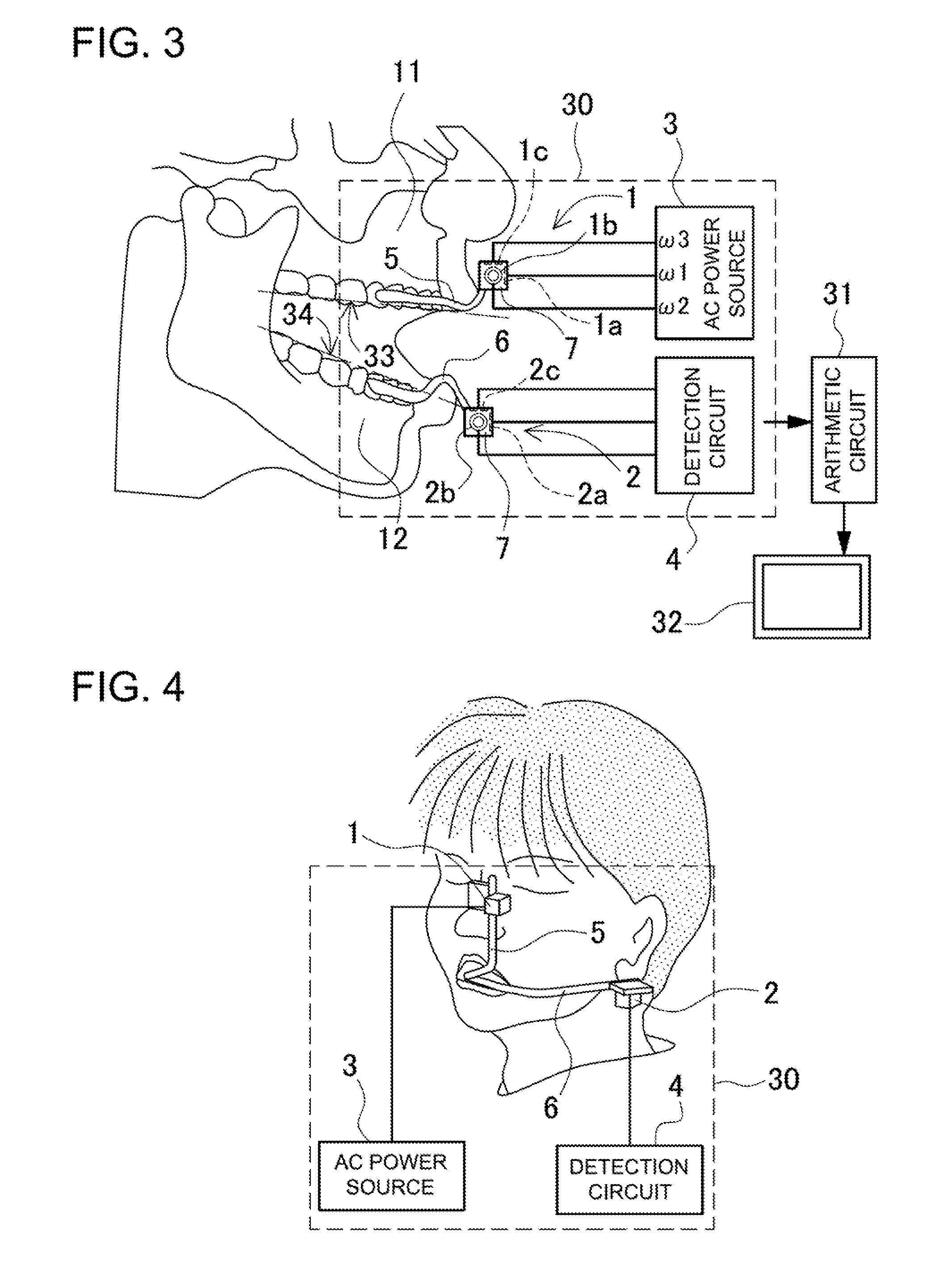 Apparatus for measuring dental occlusion