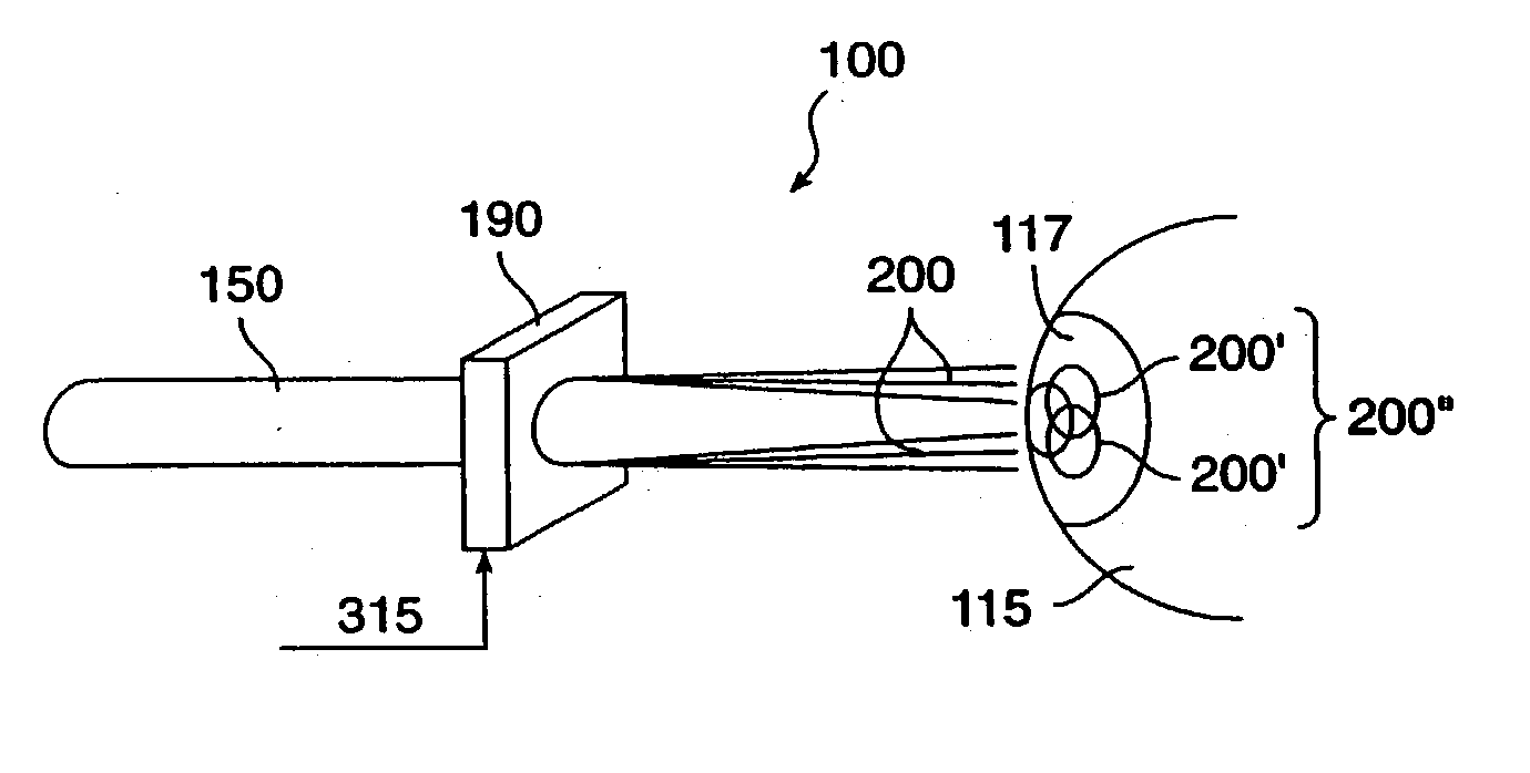 Multiple beam laser sculpting system and method