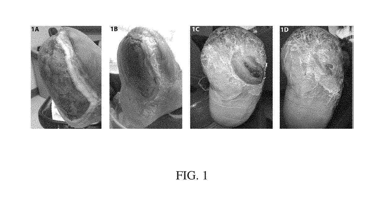 Wound healing compositions involving medicinal honey, mineral ions and methylglyoxal, and methods of use