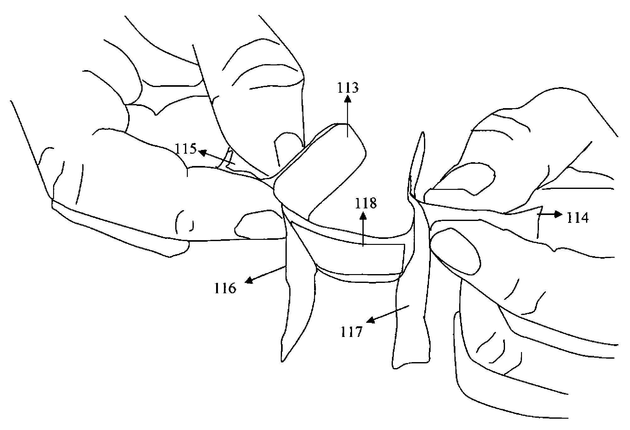 Adhesive bandage with barrier tear away tabs