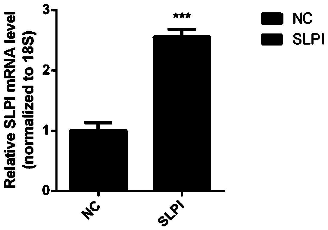 Application of secretory leukocyte protease inhibitor (SLPI) as prognostic marker of diabetic nephropathy (DN)