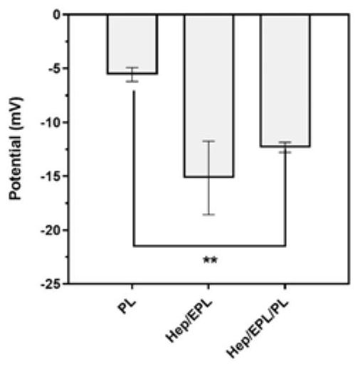 Injection-type platelet lysate-loaded temperature-sensitive hydrogel-high-dispersion nanoparticle system and application thereof