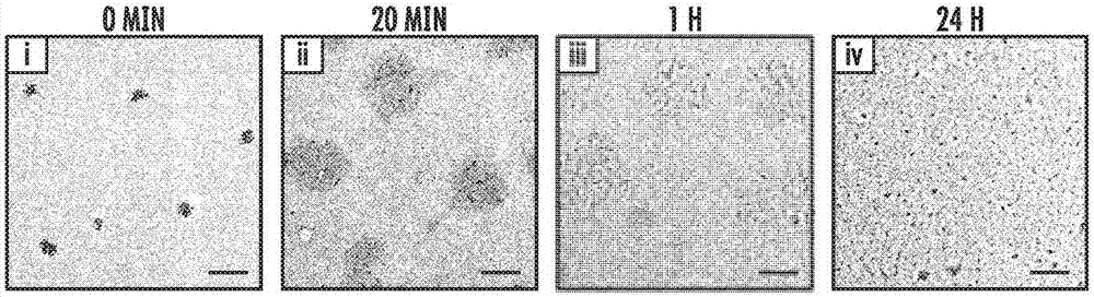 Glucose-responsive insulin delivery system using hyoxia-sensitive nanocomposites