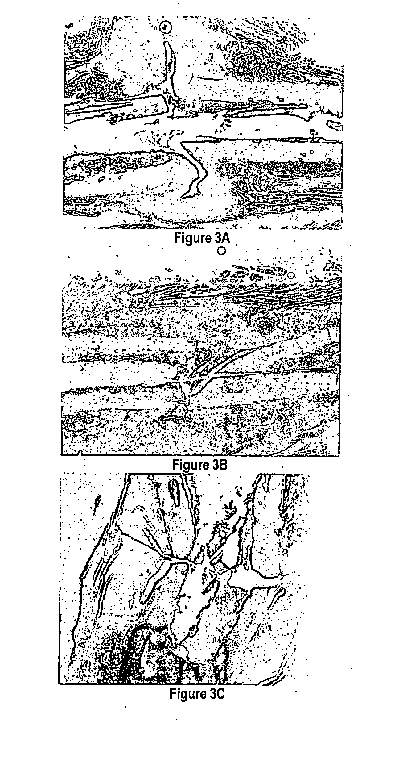 Methods and compositions for bone and cartilage repair