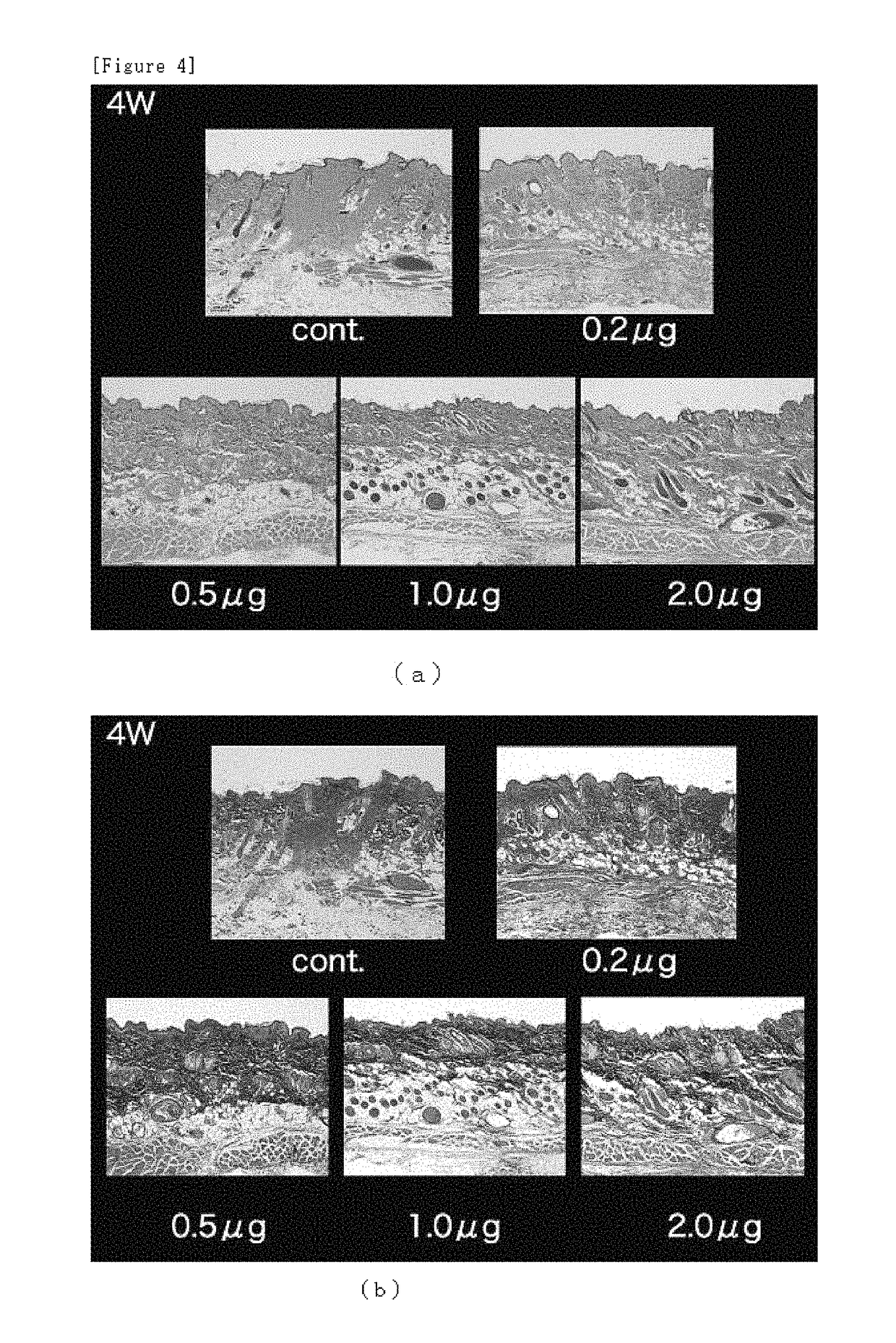 Microneedle assembly formulation for skin treatment