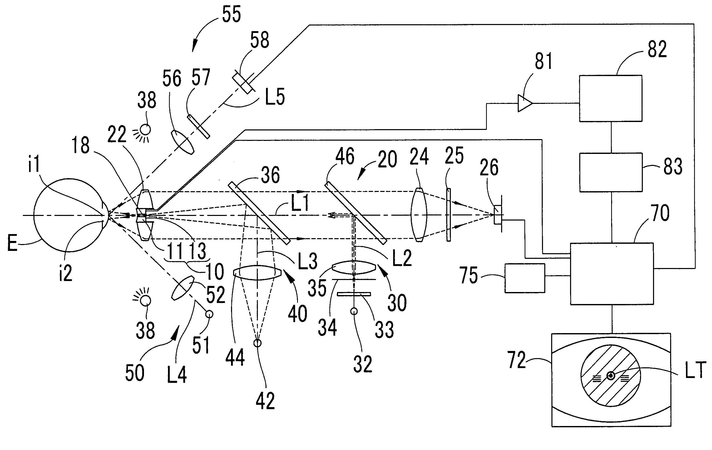 Non-Contact ultrasonic tonometer