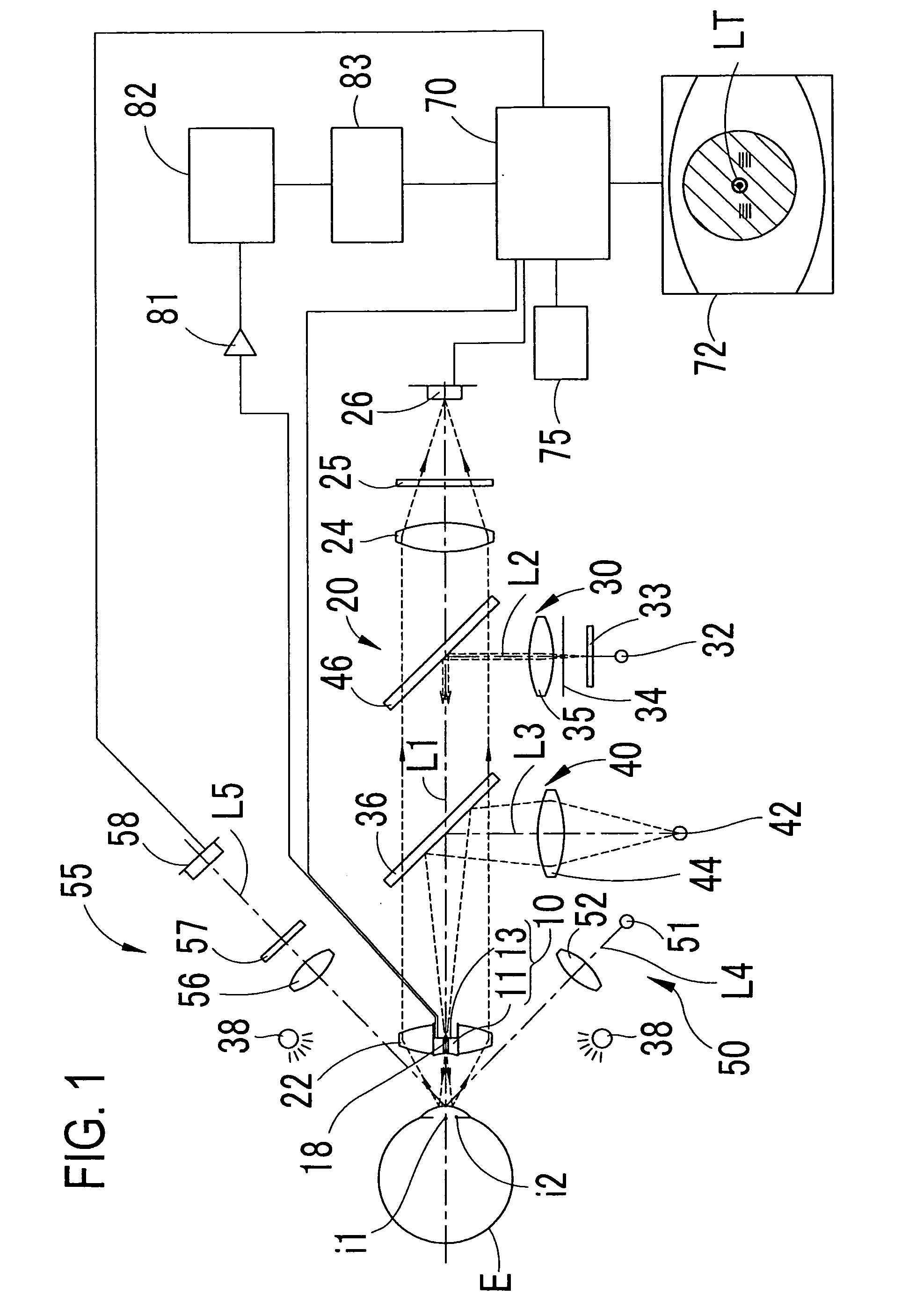 Non-Contact ultrasonic tonometer