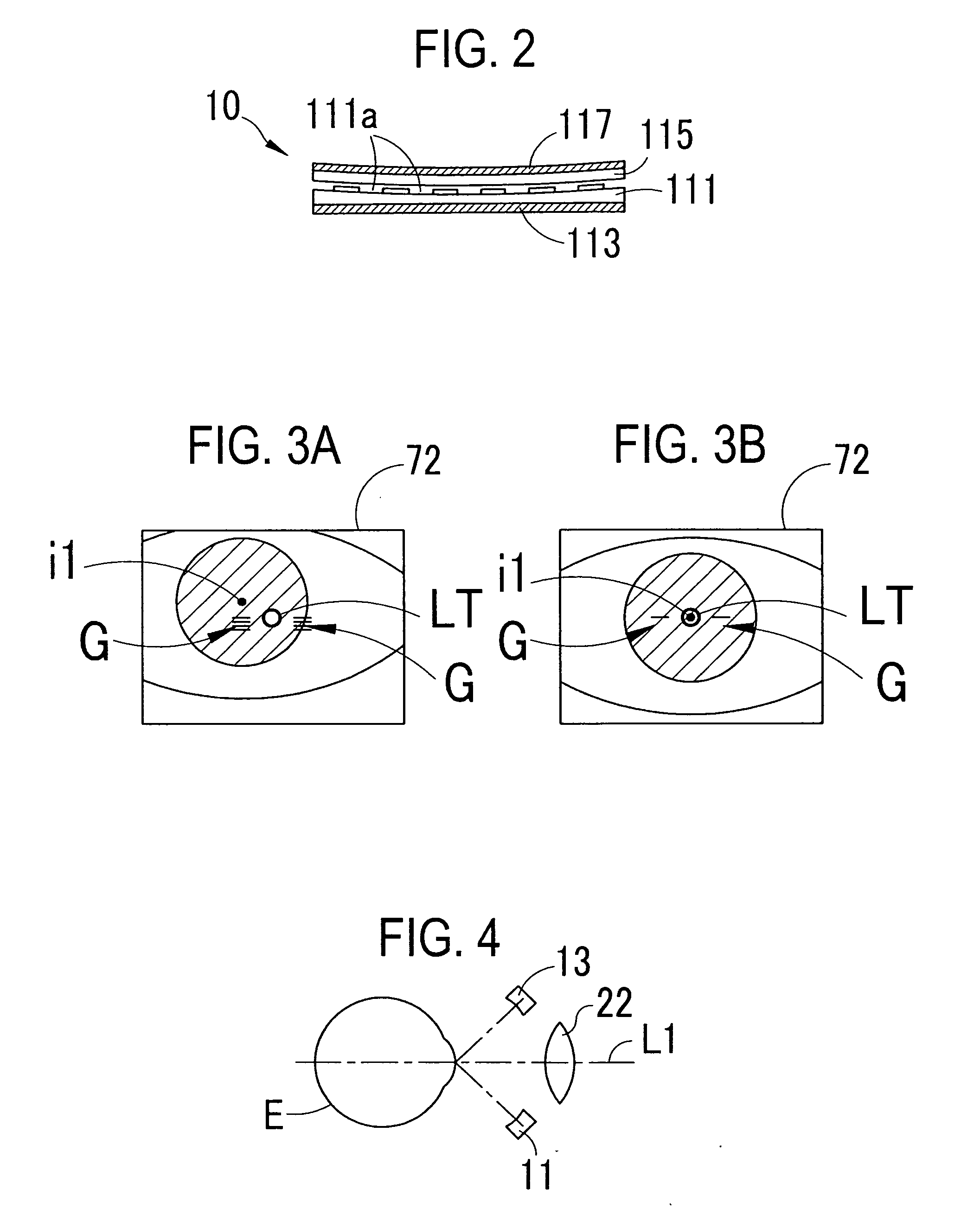 Non-Contact ultrasonic tonometer