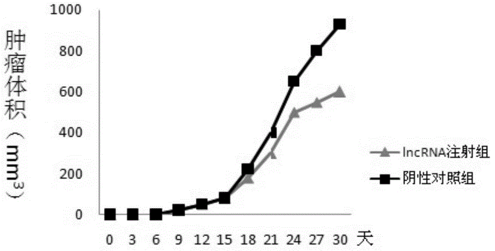 Pharmaceutical composition containing LncRNA and use thereof