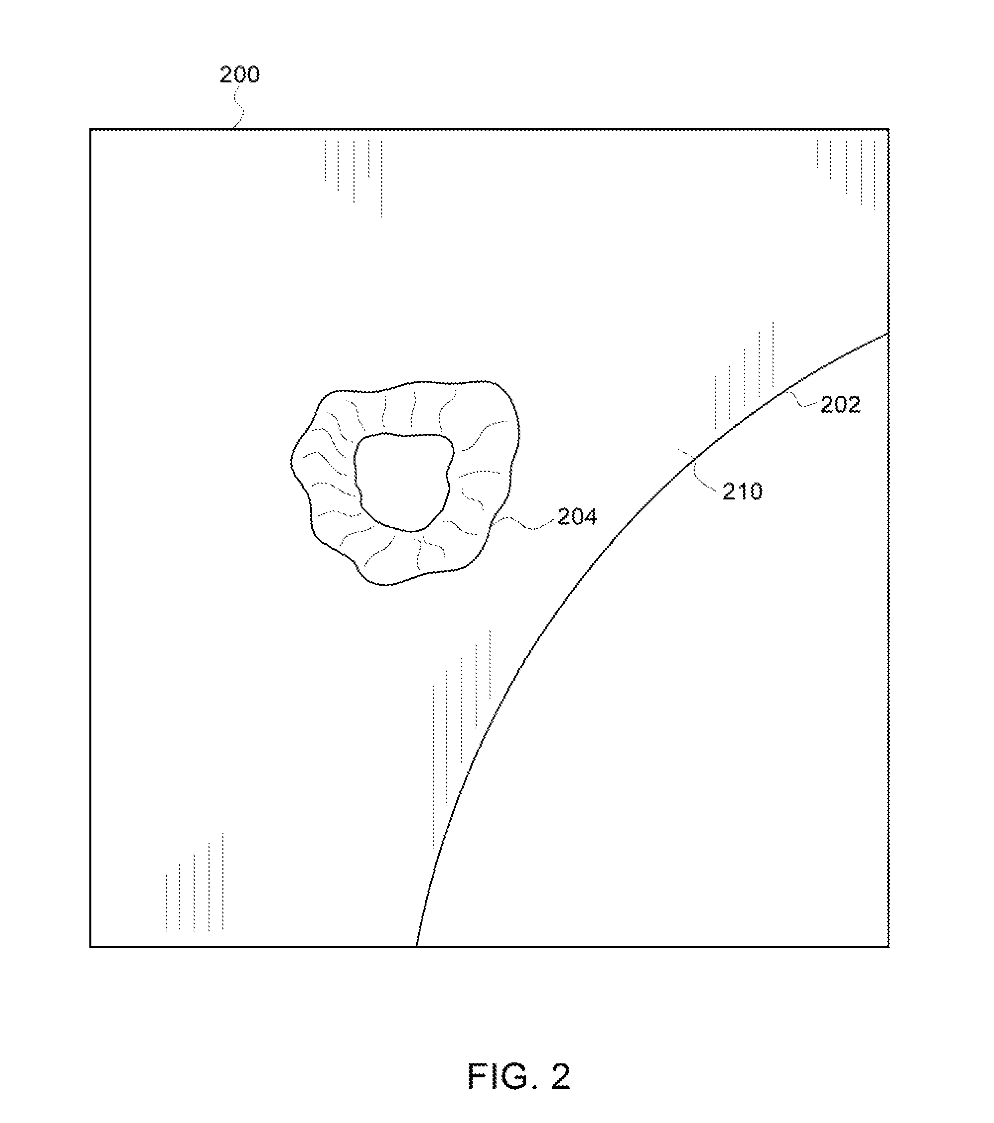 Method and device for automatically identifying a point of interest on the surface of an anomaly