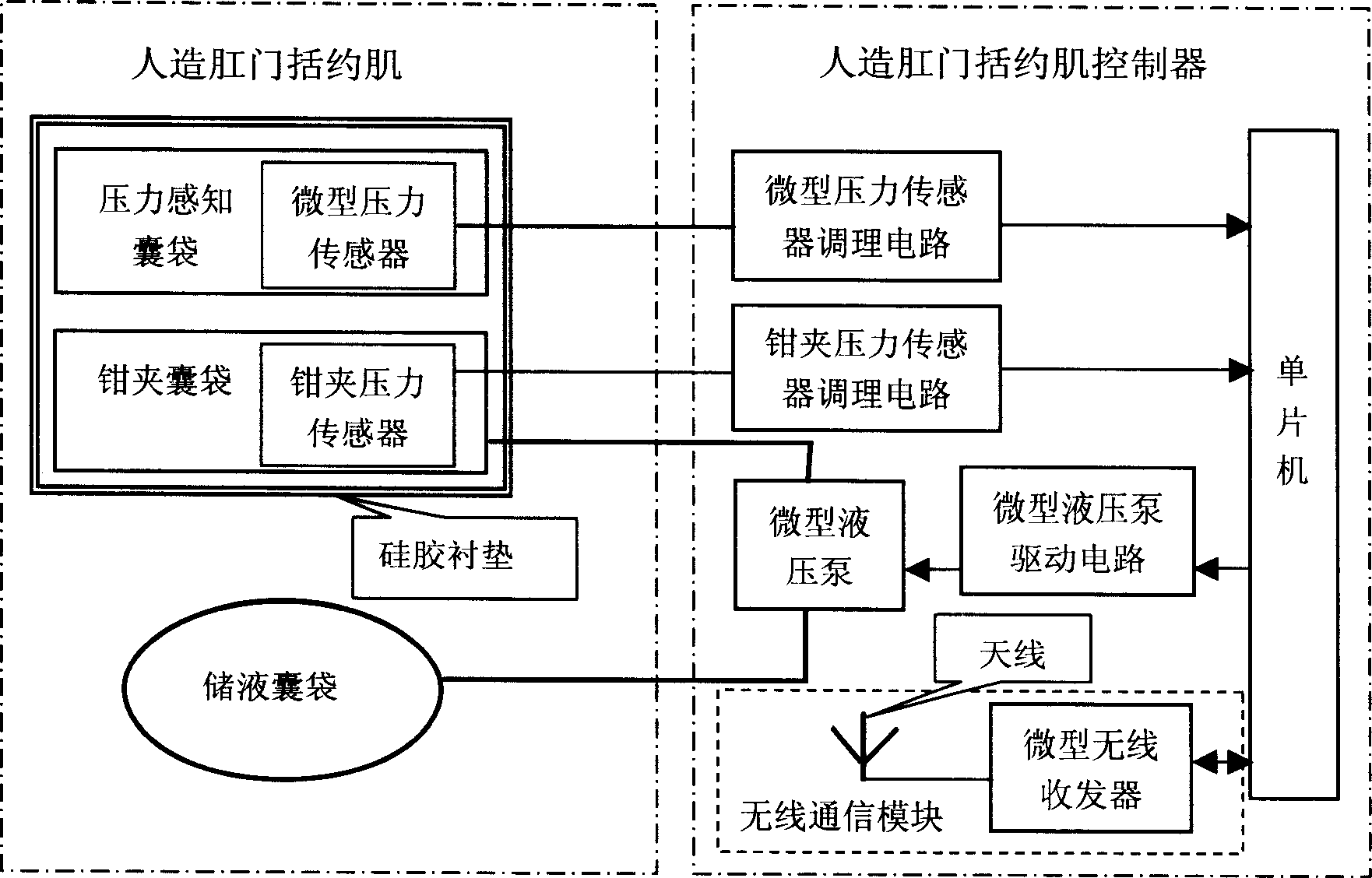 Feed-back control type artificial sphincter ani system