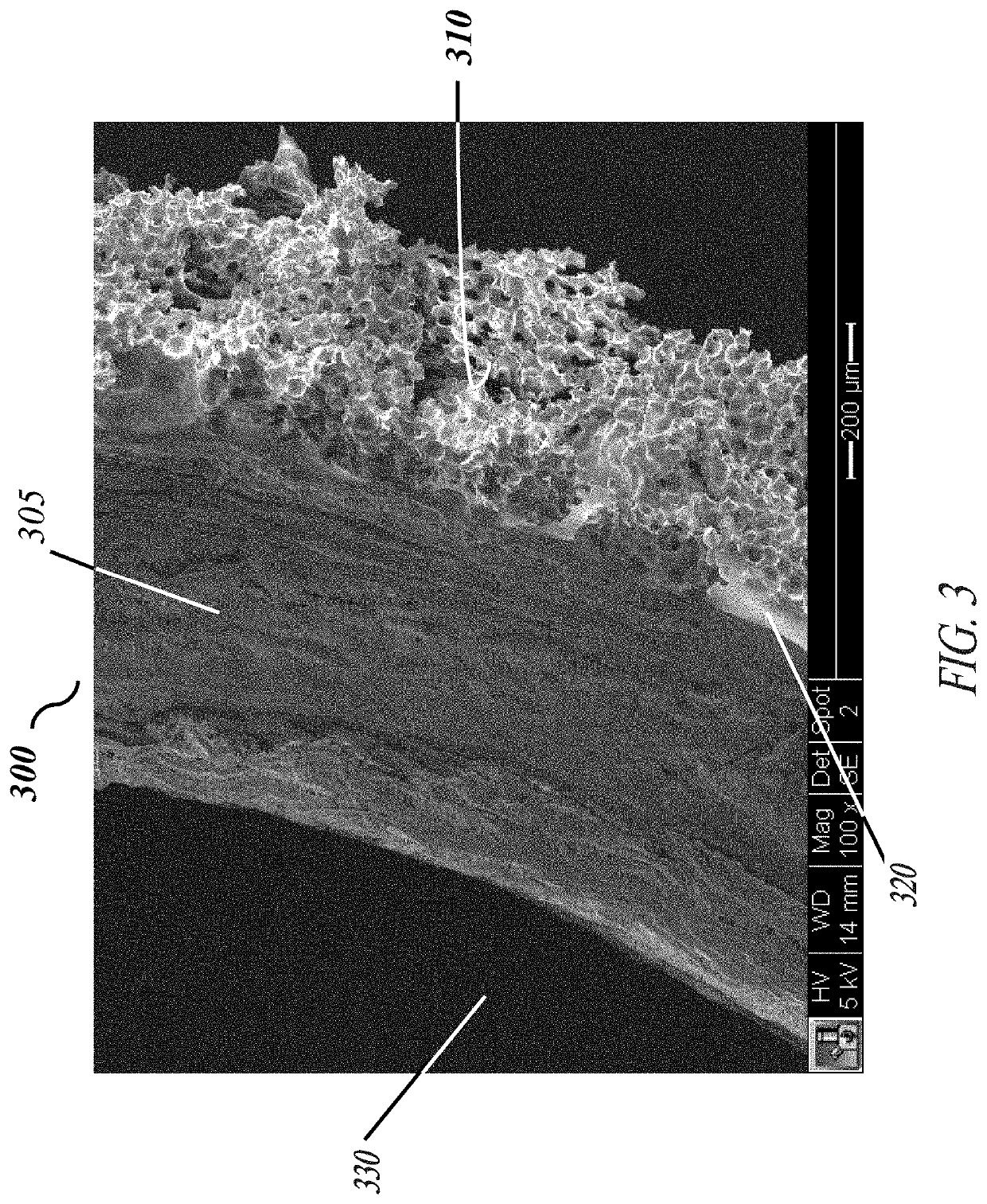 Corrugated microporous tissue interface for improved performance and infection resistance of vascular grafts and other implantable devices