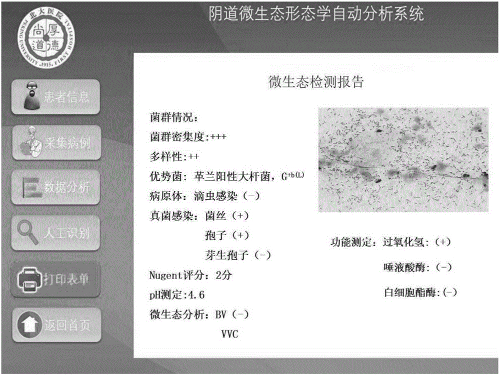 Automatic analyzing method and system for vaginal microecological morphology