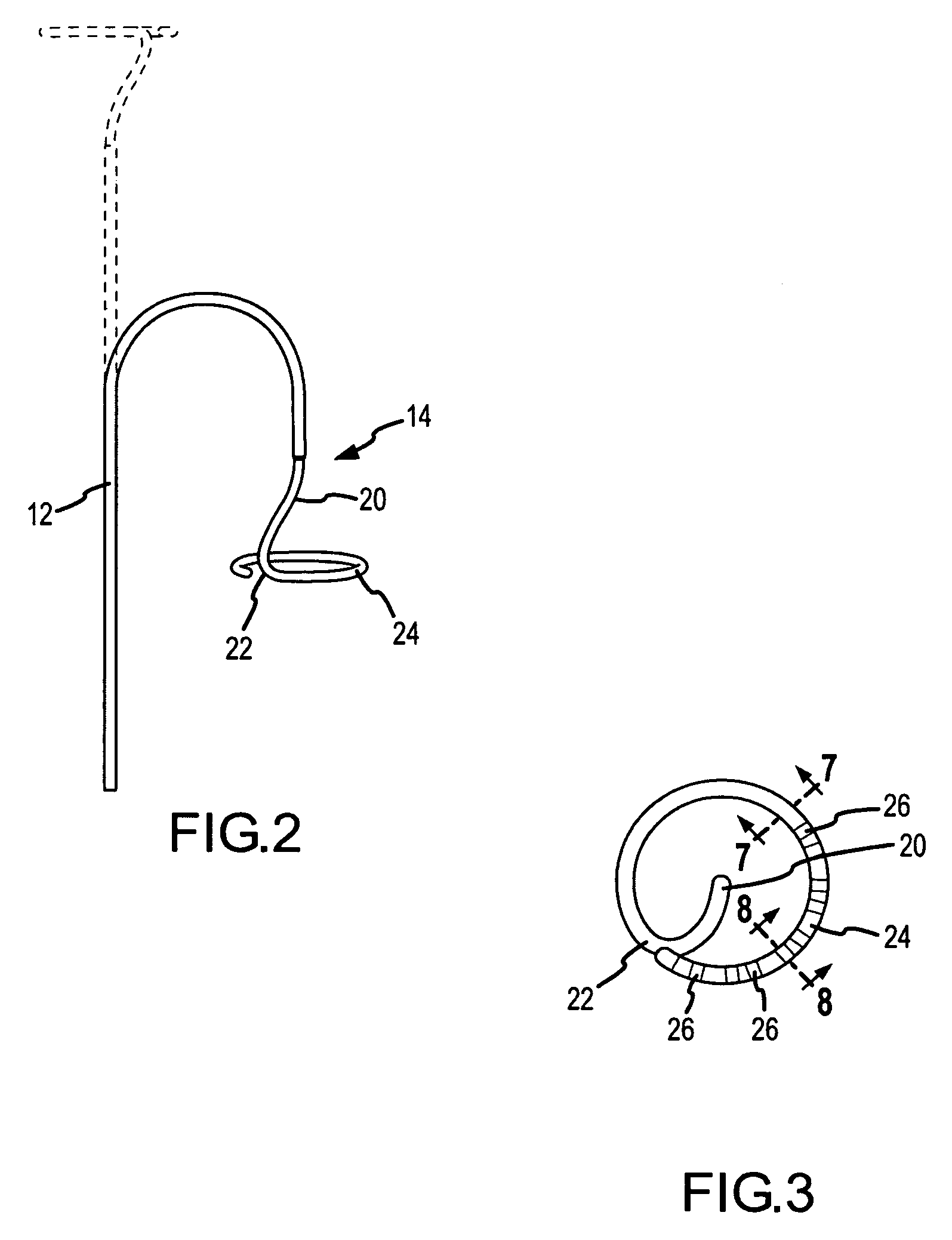 Catheter with embedded components and method of its manufacture