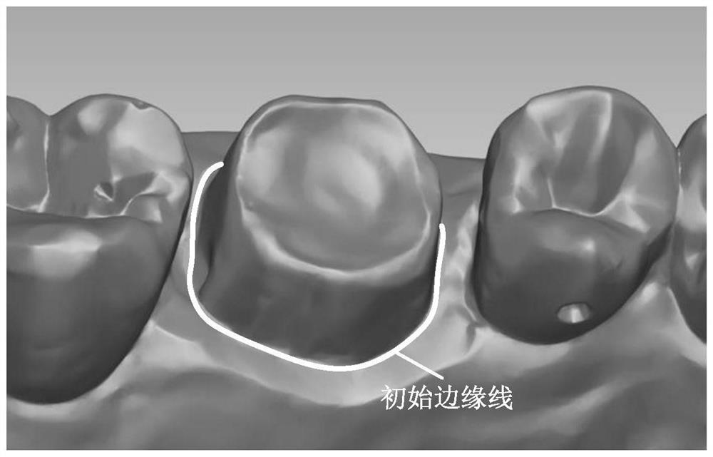 Method and device for adjusting tooth model