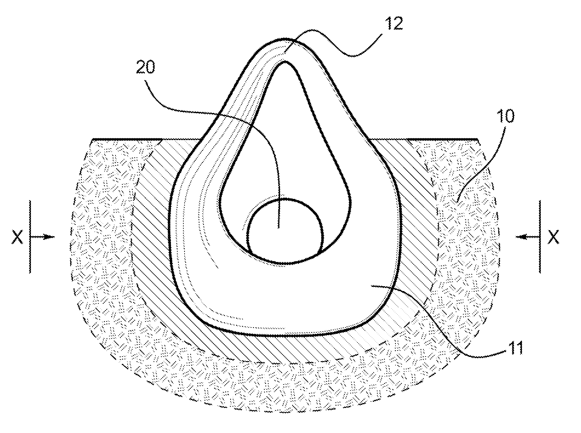 Low profile filter respirator