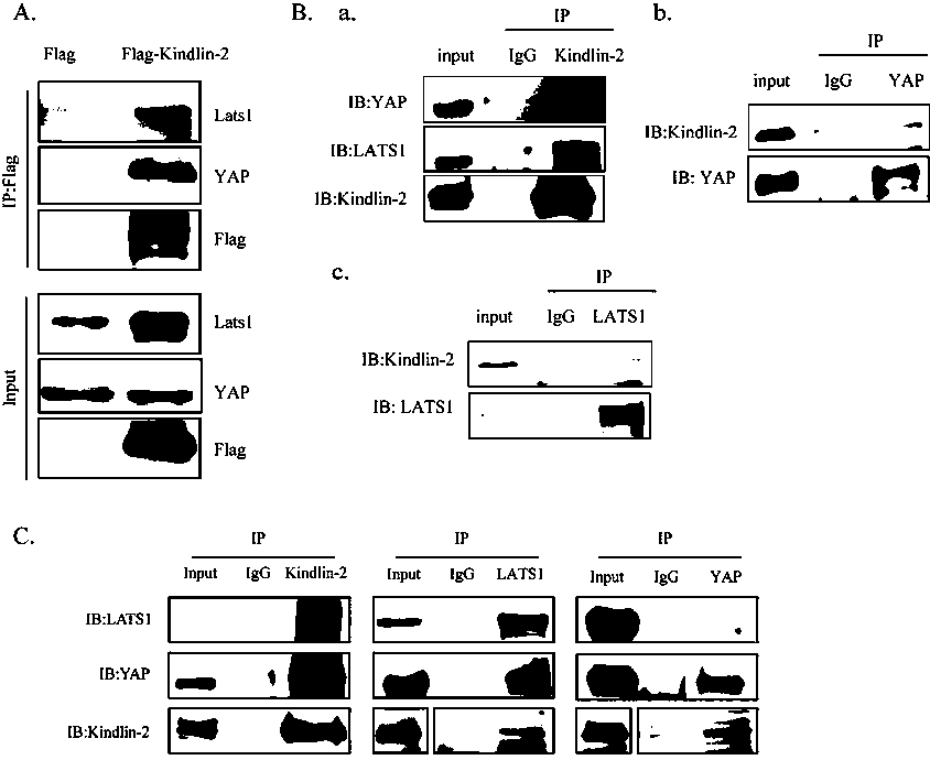 Specific long-acting siRNA and application thereof to treatment of renal fibrosis