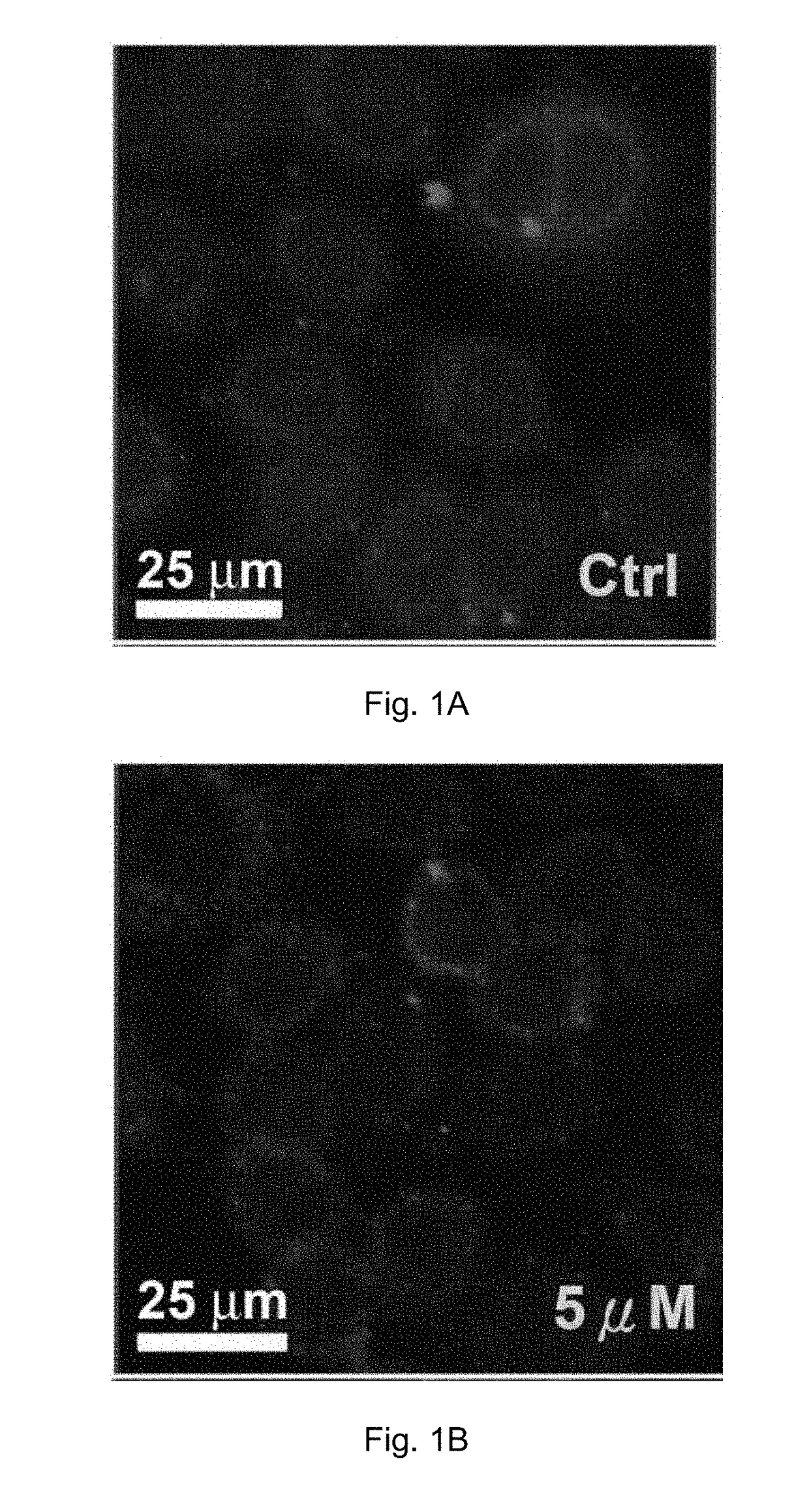 Cobalt-polypyridyl complex for treatment of cancer, a pharmaceutical composition and a kit comprising it