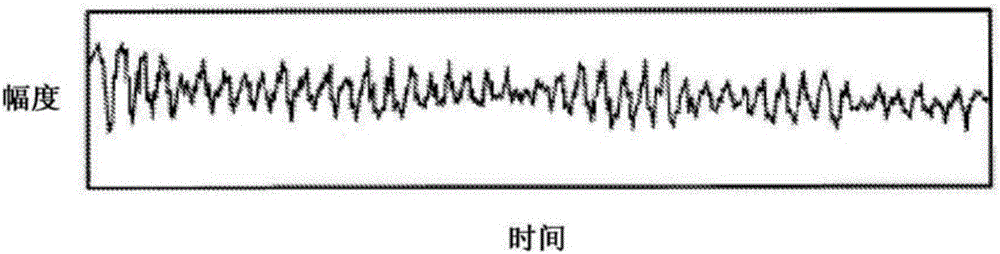 Devices and external defibrillators for providing electrotherapy to patients