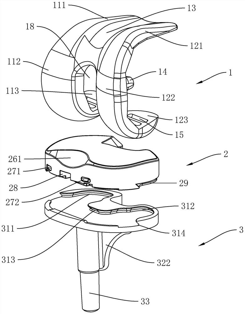 An anatomical knee joint femoral prosthesis retaining posterior cruciate ligament