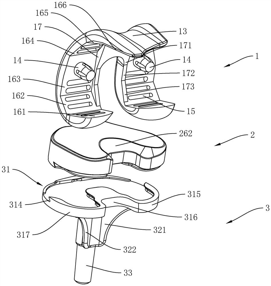 An anatomical knee joint femoral prosthesis retaining posterior cruciate ligament